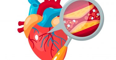 dislipidemia