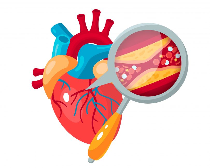 dislipidemia